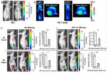 自动化所成功研发核素多模融合分子影像成像技术